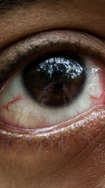 An extreme macro shot of a human eye dominating the frame, capturing intricate physiological te...